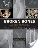 Zlomené kosti: Rádiologický atlas zlomenín a vykĺbení - Broken Bones: The Radiologic Atlas of Fractures and Dislocations