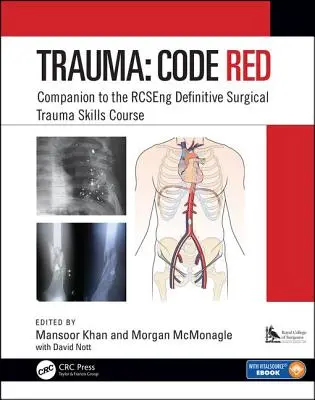 Úraz: Červený kód: Rcseng Definitive Surgical Trauma Skills Course: Červený kód: Companion to the Rcseng Definitive Surgical Trauma Skills Course - Trauma: Code Red: Companion to the Rcseng Definitive Surgical Trauma Skills Course
