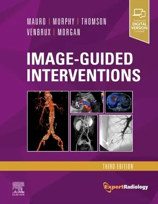 Intervencie riadené obrazom: Odborná rádiologická séria - Image-Guided Interventions: Expert Radiology Series