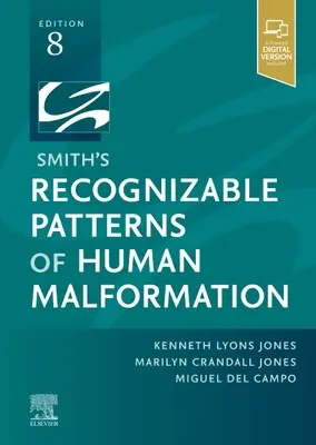 Smithove rozpoznateľné vzory ľudských malformácií - Smith'S Recognizable Patterns of Human Malformation