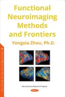 Funkčné neurozobrazovacie metódy a hranice - Functional Neuroimaging Methods and Frontiers