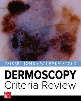 Prehľad kritérií dermoskopie - Dermoscopy Criteria Review
