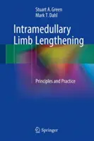 Intramedulárne predĺženie končatín: Princípy a prax - Intramedullary Limb Lengthening: Principles and Practice