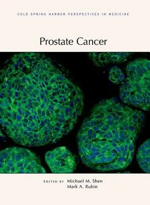 Rakovina prostaty - Prostate Cancer