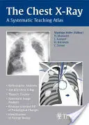 Röntgen hrudníka: Systematický výučbový atlas - The Chest X-Ray: A Systematic Teaching Atlas