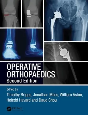 Operačná ortopédia - Operative Orthopaedics