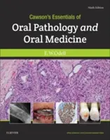 Cawsonove základy ústnej patológie a ústnej medicíny - Cawson's Essentials of Oral Pathology and Oral Medicine