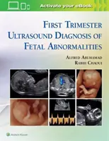 Ultrazvuková diagnostika abnormalít plodu v prvom trimestri - First Trimester Ultrasound Diagnosis of Fetal Abnormalities