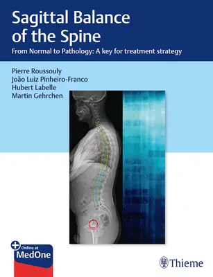 Sagitálna rovnováha chrbtice: Od normálu k patológii: Kľúč k stratégii liečby - Sagittal Balance of the Spine: From Normal to Pathology: A Key for Treatment Strategy
