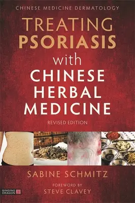 Liečba psoriázy čínskou bylinnou medicínou (revidované vydanie): Praktická príručka - Treating Psoriasis with Chinese Herbal Medicine (Revised Edition): A Practical Handbook