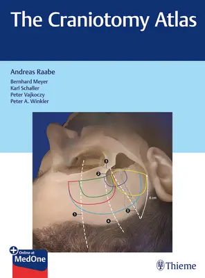 Atlas kraniotómie - The Craniotomy Atlas