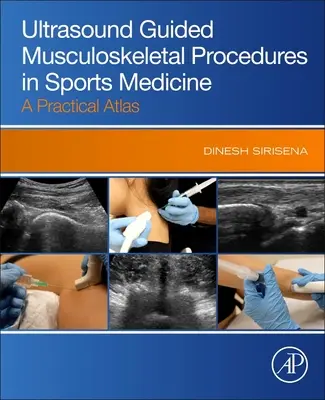 Ultrazvukom riadené muskuloskeletálne postupy v športovej medicíne - praktický atlas - Ultrasound Guided Musculoskeletal Procedures in Sports Medicine - A Practical Atlas