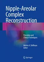 Rekonštrukcia bradavično-areolárneho komplexu: Princípy a klinické techniky - Nipple-Areolar Complex Reconstruction: Principles and Clinical Techniques