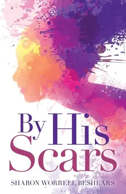 Pri jeho jazvách - By His Scars
