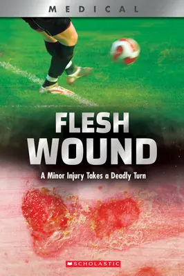 Telesné zranenie (Xbooks): Drobné zranenie sa mení na smrteľné - Flesh Wound (Xbooks): A Minor Injury Takes a Deadly Turn