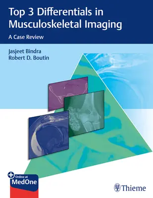 Top 3 diferenciály v zobrazovaní pohybového aparátu: Prehľad prípadov - Top 3 Differentials in Musculoskeletal Imaging: A Case Review