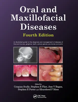 Ústne a čeľustné choroby, štvrté vydanie - Oral and Maxillofacial Diseases, Fourth Edition