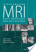 MAGNETICKÁ REZONANCIA: Základné princípy a aplikácie - MRI: Basic Principles and Applications