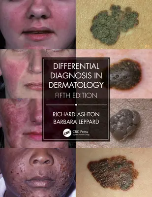 Diferenciálna diagnostika v dermatológii - Differential Diagnosis in Dermatology