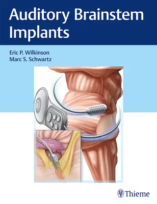 Implantáty sluchového mozgového kmeňa - Auditory Brainstem Implants
