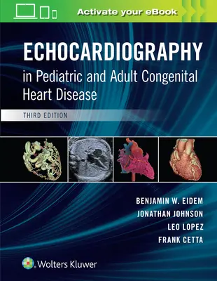Echokardiografia pri vrodených srdcových chybách detí a dospelých - Echocardiography in Pediatric and Adult Congenital Heart Disease