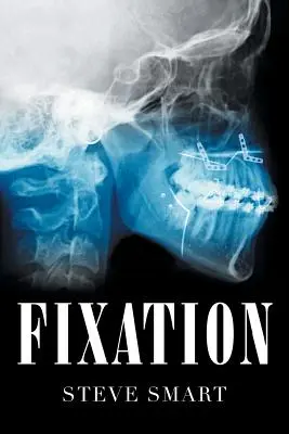 Fixácia - Fixation