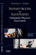 Okamžitý prístup k ortopedickému fyzikálnemu hodnoteniu - Instant Access to Orthopedic Physical Assessment