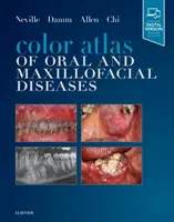 Farebný atlas ústnych a čeľustných chorôb - Color Atlas of Oral and Maxillofacial Diseases