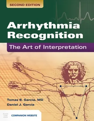 Rozpoznávanie arytmie: Umenie interpretácie: Umenie interpretácie - Arrhythmia Recognition: The Art of Interpretation: The Art of Interpretation
