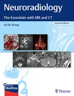 Neurorádiológia: Základné informácie o MR a CT - Neuroradiology: The Essentials with MR and CT