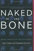 Nahý až na kosť: lekárske zobrazovanie v dvadsiatom storočí - Naked to the Bone: Medical Imaging in the Twentieth Century