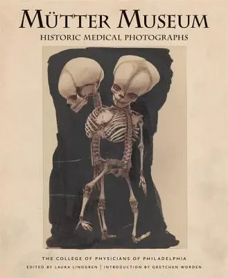 Mtter Museum Historické lekárske fotografie - Mtter Museum Historic Medical Photographs