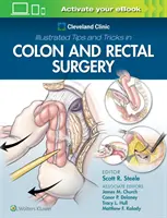 Cleveland Clinic Ilustrované tipy a triky v chirurgii hrubého čreva a konečníka - Cleveland Clinic Illustrated Tips and Tricks in Colon and Rectal Surgery