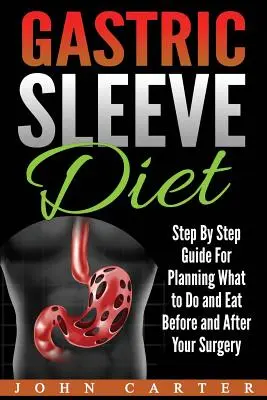 Diéta so žalúdočným rukávom: Vychytávky: krok za krokom pre plánovanie toho, čo robiť a jesť pred a po operácii - Gastric Sleeve Diet: Step By Step Guide For Planning What to Do and Eat Before and After Your Surgery