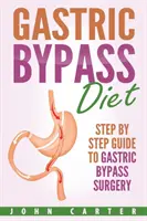 Diéta pri žalúdočnom bypasse: Sprievodca krok za krokom: Ako sa pripraviť na operáciu žalúdočného bypassu? - Gastric Bypass Diet: Step By Step Guide to Gastric Bypass Surgery