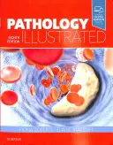Ilustrovaná patológia - Pathology Illustrated