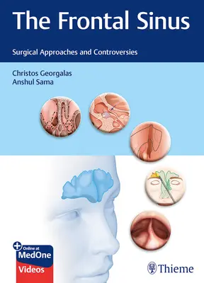 The Frontal Sinus (Čelná dutina): Chirurgické prístupy a kontroverzie - The Frontal Sinus: Surgical Approaches and Controversies