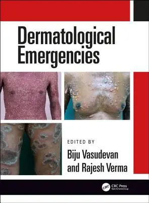 Dermatologické náhle príhody - Dermatological Emergencies