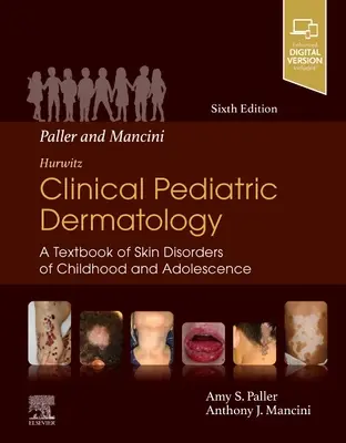 Paller a Mancini - Hurwitz Klinická pediatrická dermatológia: Učebnica kožných ochorení v detstve a dospievaní - Paller and Mancini - Hurwitz Clinical Pediatric Dermatology: A Textbook of Skin Disorders of Childhood & Adolescence
