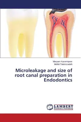 Mikroúnik a veľkosť preparácie koreňových kanálikov v endodoncii - Microleakage and size of root canal preparation in Endodontics