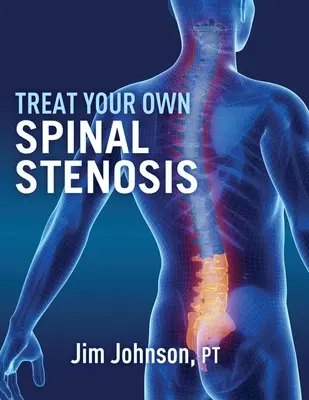 Liečba vlastnej spinálnej stenózy - Treat Your Own Spinal Stenosis