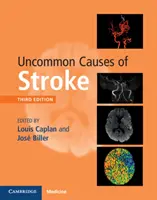 Neobvyklé príčiny mŕtvice - Uncommon Causes of Stroke