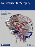 Neurovaskulárna chirurgia - Neurovascular Surgery