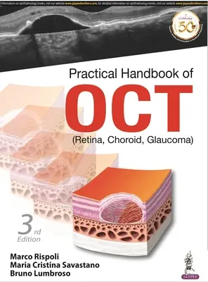 Praktická príručka OCT - (Retina, Choroid, Glaukoma) - Practical Handbook of OCT - (Retina, Choroid, Glaucoma)