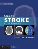 Caplanova mŕtvica: Klinický prístup - Caplan's Stroke: A Clinical Approach