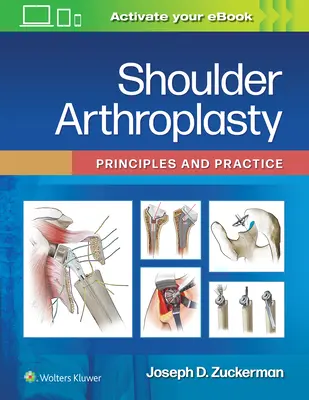 Artroplastika ramena: Princípy a prax - Shoulder Arthroplasty: Principles and Practice