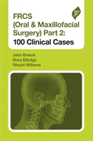 Frcs (Oral & Maxillofacial Surgery) Part 2: 100 Clinical Cases