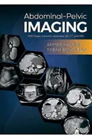 Abdominálno-pelvické zobrazovanie - 200 prípadov (bežné choroby): US, CT a MRI - Abdominal-Pelvic Imaging - 200 Cases (Common Diseases): US, CT and MRI