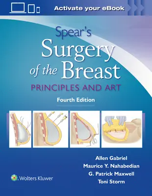 Spearova chirurgia prsníka: Srdce a srdce: Princípy a umenie - Spear's Surgery of the Breast: Principles and Art