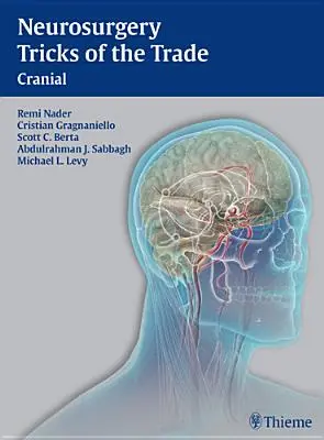 Neurochirurgické triky - kraniálne: Kraniálne - Neurosurgery Tricks of the Trade - Cranial: Cranial